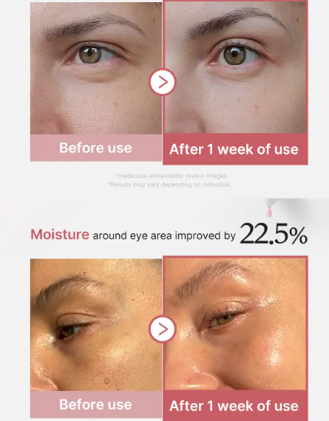 MEDICUBE C OJOS PDRN3.png