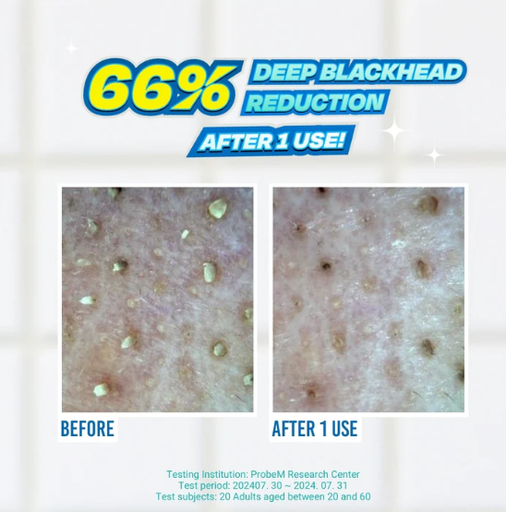 JUMISO PUNTOS NEGROS 2.png