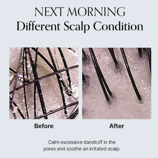 TRATAMIENTO SCALP 3.png