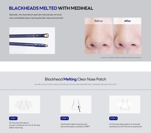 mediheal blackhead 4.jpg