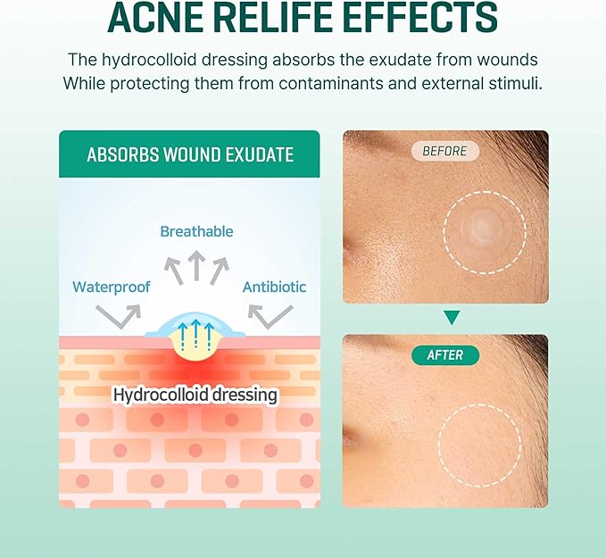 some by mi parches 3.jpg